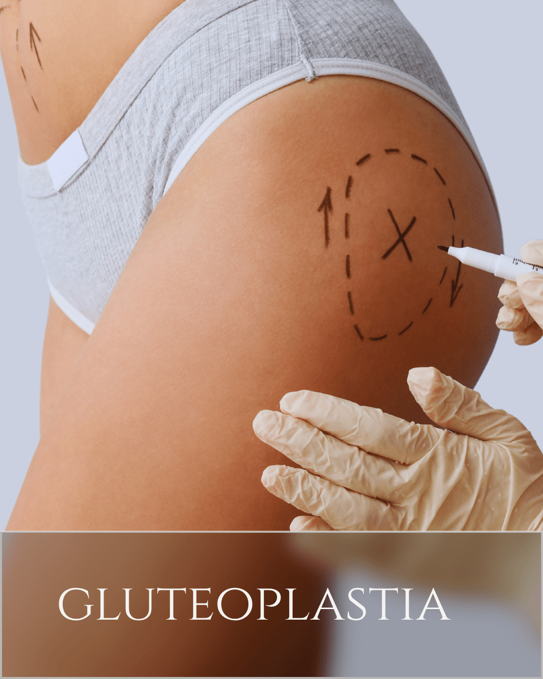 gluteo (1)