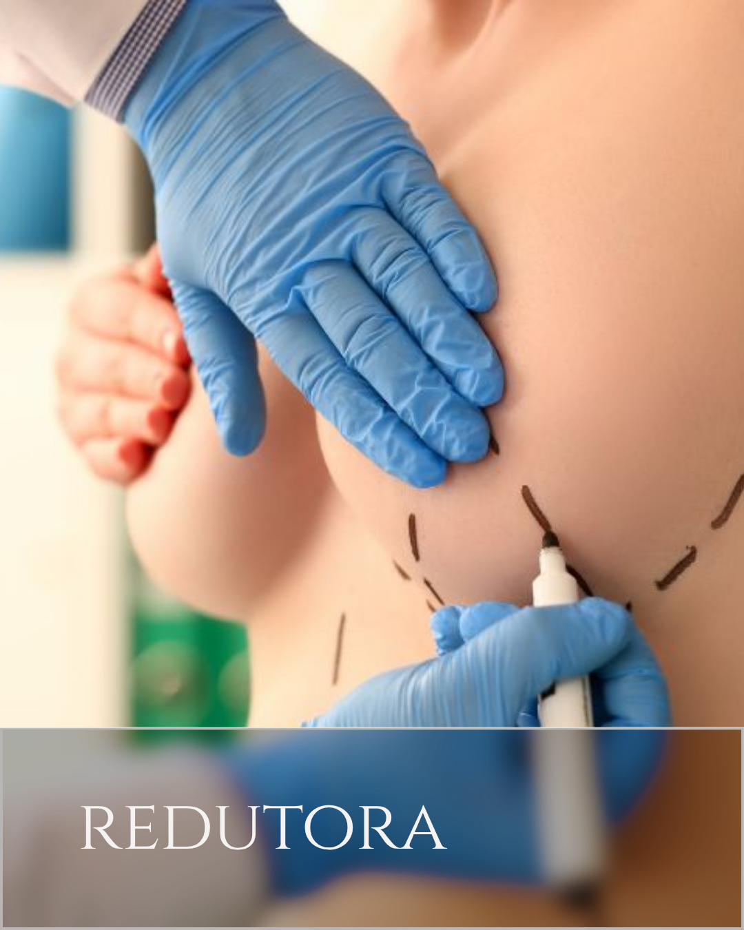 mama redutora